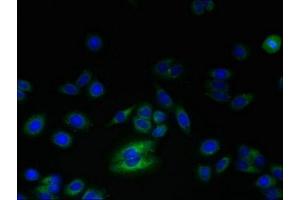 Immunofluorescent analysis of HepG2 cells using ABIN7168256 at dilution of 1:100 and Alexa Fluor 488-congugated AffiniPure Goat Anti-Rabbit IgG(H+L) (RNF24 anticorps  (AA 45-148))