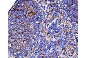 IHC analysis of Cd38 using anti-Cd38 antibody (ABIN7602864). (CD38 anticorps  (C-Term))