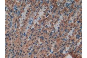 Detection of ND5 in Rat Stomach Tissue using Polyclonal Antibody to NADH Dehydrogenase 5 (ND5)