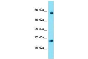Host: Rabbit  Target Name: Ap1s1  Sample Tissue: Mouse Heart lysates  Antibody Dilution: 1. (AP1S1 anticorps  (C-Term))