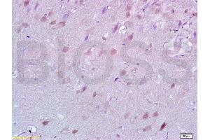 Formalin-fixed and paraffin embedded rat brain tissue labeled with Anti-Lingo-1 Polyclonal Antibody, Unconjugated (ABIN738801) at 1:200 followed by conjugation to the secondary antibody and DAB staining (LINGO1 anticorps  (AA 521-620))