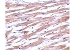 Immunohistochemistry of UNG1 in human heart tissue with this product at 2 μg/ml. (UNG anticorps  (C-Term))
