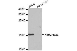 Western blot analysis of extracts of various cell lines, using Asymmetric DiMethyl-Histone H3-R2 antibody. (Histone 3 anticorps  (H3R2me2))