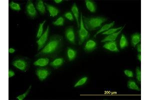 Immunofluorescence of monoclonal antibody to USP47 on HeLa cell.