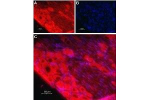 Expression of TrkC in rat dorsal root ganglia - Immunohistochemical staining of rat dorsal root ganglia (DRG) frozen sections using Anti-TrkC (extracellular) Antibody (ABIN7043391, ABIN7044775 and ABIN7044776), (1:100).