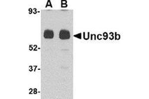 Western blot analysis of Unc93b in human heart tissue lysate with this product at (A) 0. (UNC93B1 anticorps  (N-Term))