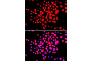 Immunofluorescence analysis of A549 cell using STK19 antibody. (STK19 anticorps)