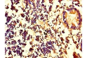 Immunohistochemistry of paraffin-embedded human appendix tissue using ABIN7162734 at dilution of 1:100