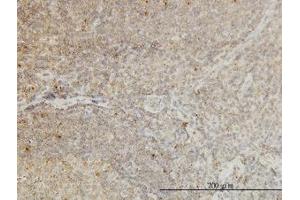 Image no. 1 for anti-Cyclin-Dependent Kinase-Like 4 (CDKL4) (AA 196-295) antibody (ABIN466282) (CDKL4 anticorps  (AA 196-295))