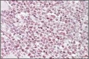 Staining of paraffin embedded Human Tonsil using IKAROS antibody at 1 µg/ml. (IKZF1 anticorps  (Internal Region))