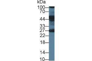 Detection of ERLIN2 in Human Milk using Polyclonal Antibody to Endoplasmic Reticulum Lipid Raft Associated Protein 2 (ERLIN2) (ERLIN2 anticorps  (AA 47-339))