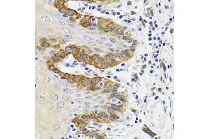 Immunohistochemistry of paraffin-embedded Human trachea using ESD antibody (ABIN5973666) at dilution of 1/100 (40x lens).