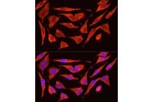 Immunofluorescence analysis of HeLa cells using POMC Rabbit pAb (ABIN3017230, ABIN3017231, ABIN3017232 and ABIN6220004) at dilution of 1:200 (40x lens).