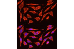 Immunofluorescence analysis of HeLa cells using POMC Rabbit pAb (ABIN3017230, ABIN3017231, ABIN3017232 and ABIN6220004) at dilution of 1:200 (40x lens).