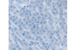 Used in DAB staining on fromalin fixed paraffin- embedded liver tissue