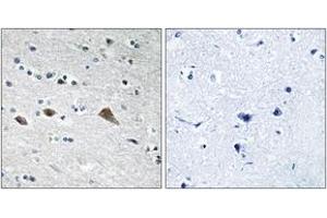 Immunohistochemistry analysis of paraffin-embedded human brain tissue, using BCAR3 Antibody. (BCAR3 anticorps  (AA 761-810))