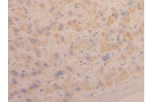 Detection of CLCF1 in Human Liver Tissue using Polyclonal Antibody to Cardiotrophin Like Cytokine Factor 1 (CLCF1)