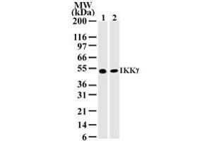 IKKgamma Western Blot.