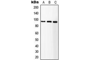 Western blot analysis of IGF1 Receptor expression in HEK293T (A), SP2/0 (B), NIH3T3 (C) whole cell lysates. (IGF1R anticorps  (C-Term))