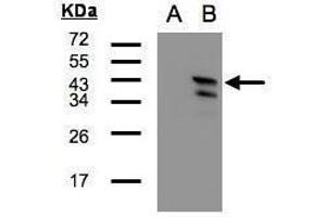 WB Image Western Blot analysis of CAMK1D expression in transfected 293T cell line by CAMK1D polyclonal antibody. (CAMK1D anticorps)