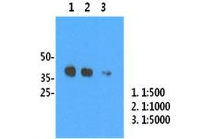 H1N1/HA1 recombinant protein (50ng) were resolved by SDS-PAGE, transferred to PVDF membrane and probed with anti-human H1N1/HA1 antibody (1:500). (Influenza Hemagglutinin HA1 Chain anticorps (Influenza A Virus H1N1))