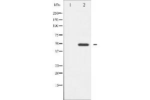 Western blot analysis of GATA4 expression in HeLa whole cell lysates,The lane on the left is treated with the antigen-specific peptide. (GATA4 anticorps  (Internal Region))