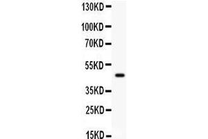 Western Blotting (WB) image for anti-Plasminogen Activator Inhibitor 2 (SERPINB2) (AA 1-180) antibody (ABIN3043329) (SERPINB2 anticorps  (AA 1-180))