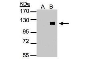 WB Image Western Blot analysis of ZNF281 expression in transfected 293T cell line by ZNF281 polyclonal antibody. (ZNF281 anticorps)