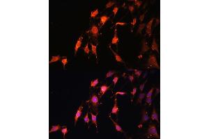 anti-Proline Rich 5 (Renal) (PRR5) (AA 109-388) antibody