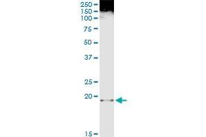 Immunoprecipitation of FTL transfected lysate using anti-FTL monoclonal antibody and Protein A Magnetic Bead , and immunoblotted with FTL purified MaxPab rabbit polyclonal antibody.