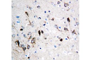Anti-NMDAR1 antibody, IHC(P) IHC(P): Rat Brain Tissue