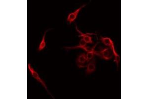 ABIN6275298 staining COLO205 by IF/ICC. (Neurexophilin 4 anticorps  (Internal Region))