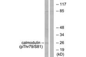 Western blot analysis of extracts from Jurkat cells treated with Insulin 0. (Calmodulin 1 anticorps  (pThr79))