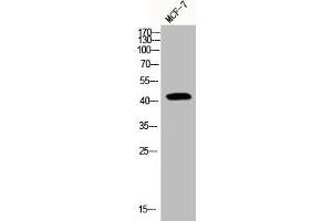 Western Blot analysis of MCF7 cells using Phospho-YAP (S127) Polyclonal Antibody
