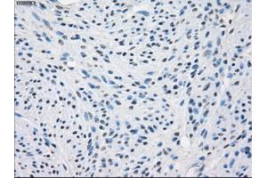 Immunohistochemical staining of paraffin-embedded Kidney tissue using anti-FCGR2A mouse monoclonal antibody. (FCGR2A anticorps)