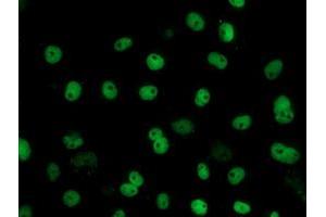 Image no. 10 for anti-Fragile X Mental Retardation 1 (FMR1) antibody (ABIN1498287)