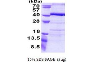 SDS-PAGE (SDS) image for Ankyrin Repeat Domain 54 (ANKRD54) (AA 1-300) protein (His tag) (ABIN6387201) (ANKRD54 Protein (AA 1-300) (His tag))