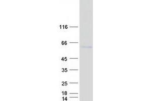 Validation with Western Blot