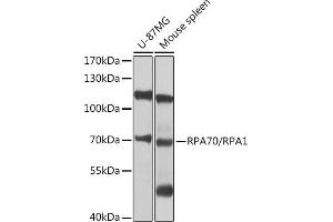 Western blot analysis of extracts of various cell lines, using RP/RP/RP antibody (ABIN3021243, ABIN3021244, ABIN3021245 and ABIN6214082) at 1:1000 dilution. (RPA1 anticorps  (AA 367-616))