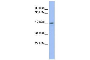 HDAC11 antibody used at 1 ug/ml to detect target protein. (HDAC11 anticorps  (Middle Region))