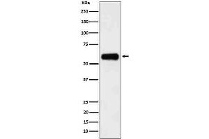 Western blot analysis of CD116 in 293 cell lysate.