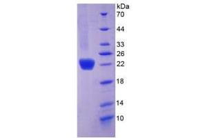 SDS-PAGE analysis of Mouse COL6a1 Protein. (COL6A1 Protéine)