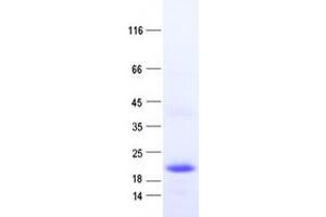 Validation with Western Blot (TCL6 Protein (His tag))
