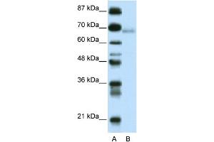 WB Suggested Anti-ZBTB22 Antibody Titration:  0. (ZBTB22 anticorps  (C-Term))