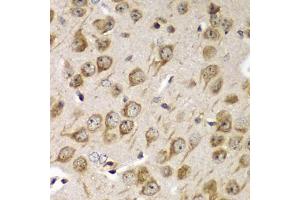 Immunohistochemistry of paraffin-embedded mouse brain using TMED10 Antibody (ABIN5974099) at dilution of 1/100 (40x lens). (TMED10 anticorps)
