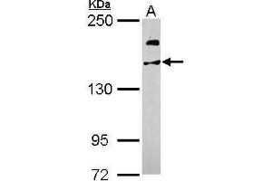WB Image Sample (50 ug of whole cell lysate) A: Mouse brain 5% SDS PAGE antibody diluted at 1:1000