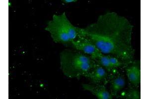 Anti-POR mouse monoclonal antibody (ABIN2453490) immunofluorescent staining of COS7 cells transiently transfected by pCMV6-ENTRY POR (RC202172). (POR anticorps)