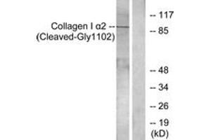 Western blot analysis of extracts from Jurkat cells, treated with etoposide 25uM 24h, using Collagen I alpha2 (Cleaved-Gly1102) Antibody. (COL1A2 anticorps  (Cleaved-Gly1102))