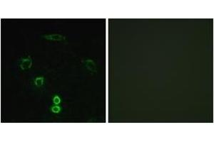 Immunofluorescence analysis of A549 cells, using GLCTK Antibody. (GLYCTK anticorps  (AA 101-150))