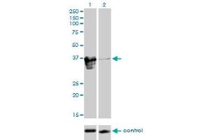 Western blot analysis of ZFP36L1 over-expressed 293 cell line, cotransfected with ZFP36L1 Validated Chimera RNAi (Lane 2) or non-transfected control (Lane 1). (ZFP36L1 anticorps  (AA 1-108))